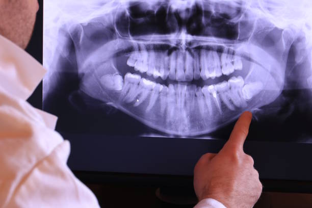 Best Root Canal Emergency Dentist  in Mill City, OR