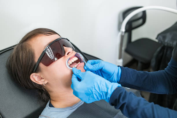 Best Teeth Whitening  in Mill City, OR
